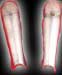 Bloodsoaked Legplates